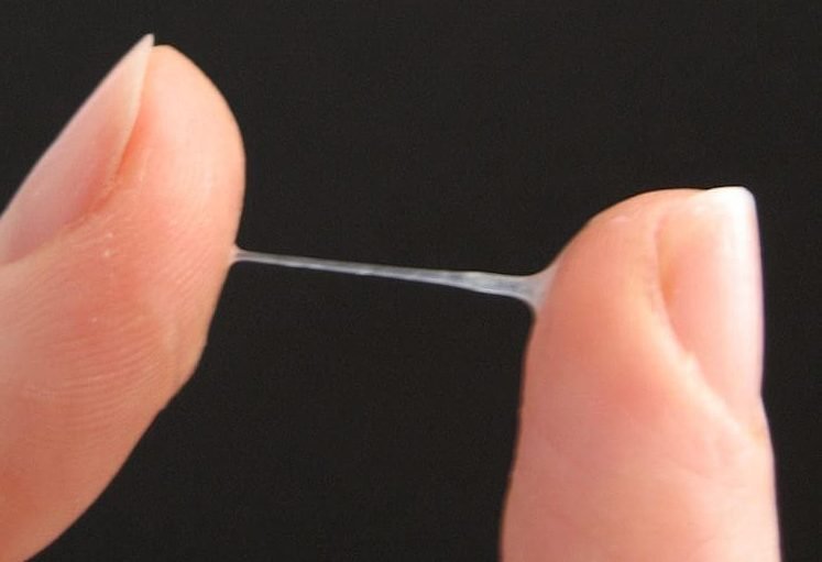 Corrimento vaginal: o que é normal? - Instituto Villamil