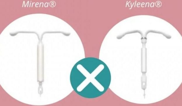 Qual a diferença entre DIU Kyleena e Mirena? - Instituto Villamil