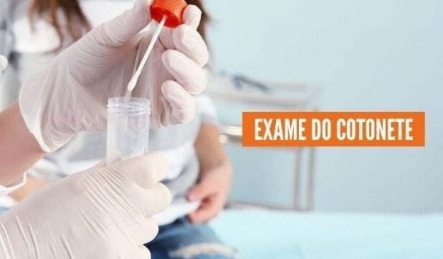 Streptococcus B na gestante: como é o exame do cotonete?