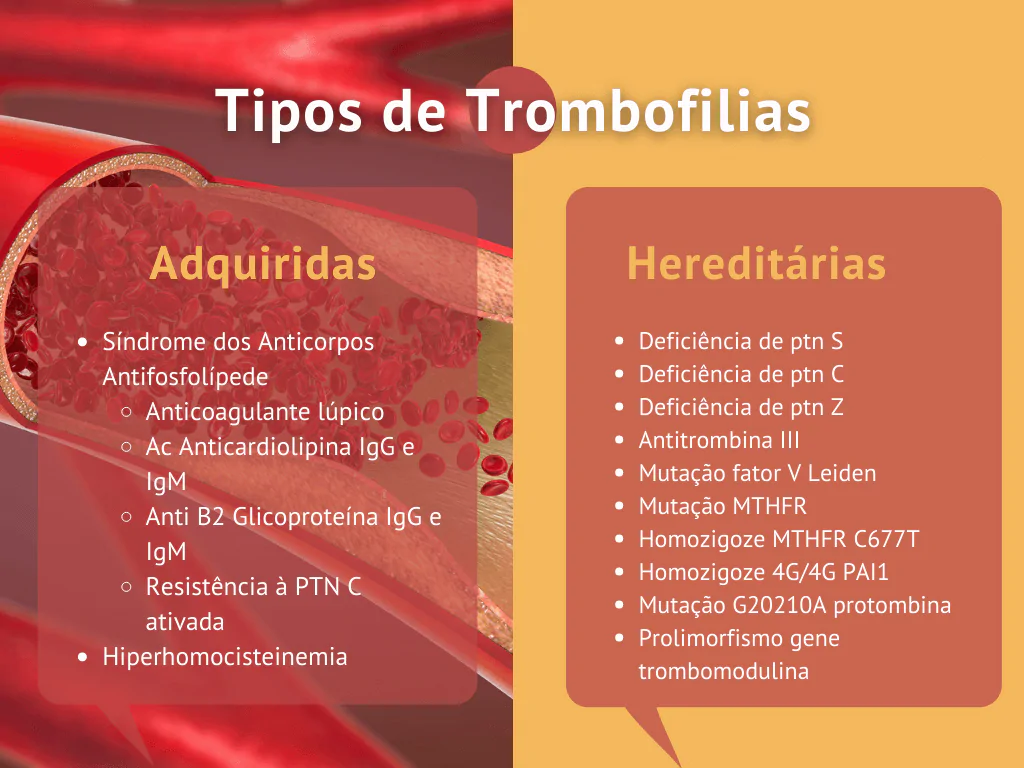 Exames de trombofilia: quando e para quem? - Instituto Villamil