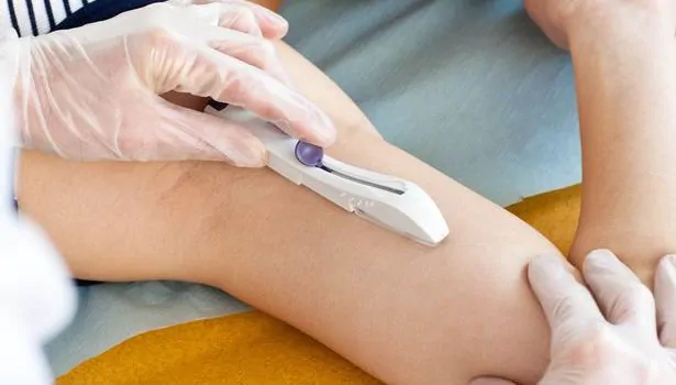 IMPLANON: Como funciona o chip anticoncepcional - Instituto Villamil